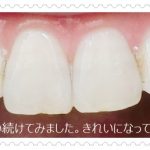 marvisマービス 歯磨き粉 ホワイトニング 効果を口コミ　梨花愛用歯磨き粉